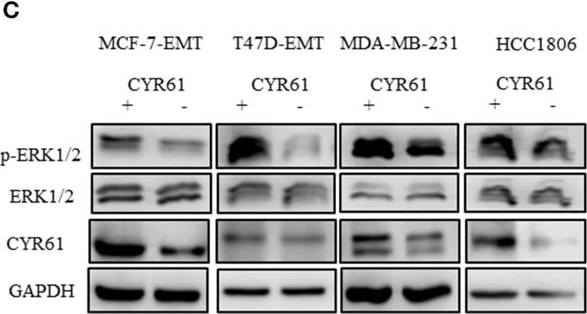 Western Blot: Cyr61/CCN1 Antibody [DyLight 550] [NB100-356R] - ERK1/2 activity is transducer of CYR61 mediated S100A4 regulation. (A) Scheme illustrating hypothesis of CYR61 regulating S100A4 in a p-ERK1/2 dependent manner. (B) ERK1/2 & p-Erk1/2 (Thr202/Tyr204) expression in different breast cancer cell lines detected by western blotting. (C) ERK1/2 & p-Erk1/2 (Thr202/Tyr204) & CYR61 expression in different breast cancer cell lines after transient CYR61 transfection detected by western blotting. (D) Relative S100A4 expression of invasive breast cancer cell lines treated with 10 μM U0126 compared to DMSO controls. Data represent mean ± SEM. Using unpaired, two-tailed t-test analysis. n = 3; *P < 0.05;**P < 0.01;***P < 0.005 (E) 3D invasion analysis of breast cancer spheroids seeded after U0126 treatment. Spheroid area was assessed 48 h after adding Matrigel using polygonal selection & compared to spheroid area at time point 0 (adding of Matrigel + 10 μM U0126). Area growth was compared to area growth of control spheroids. Data represent mean ± SEM. Using unpaired, two-tailed t-test analysis. MCF-7-EMT n = 6; T47D-EMT n = 5; MDA-MB-231 n = 6; HCC1806 n = 5; **P < 0.01;***P < 0.005;****P < 0.0001 (F) Analysis of relative AlamarBlue reduction as indicator for cell viability. Breast cancer cell spheroids were grown & AlamarBlue reduction was assessed 48 h after adding Matrigel & 10 μM U0126 at 4 h incubation. Relative AlamarBlue reduction was calculated compared to DMSO control spheroids. Data represent mean ± SEM. MCF-7-EMT n = 3; T47D-EMT n = 4; MDA-MB-231 n = 3; HCC1806 n = 3; *P < 0.05;**P < 0.01. Image collected & cropped by CiteAb from the following publication (//pubmed.ncbi.nlm.nih.gov/31709177), licensed under a CC-BY license. Not internally tested by Novus Biologicals.