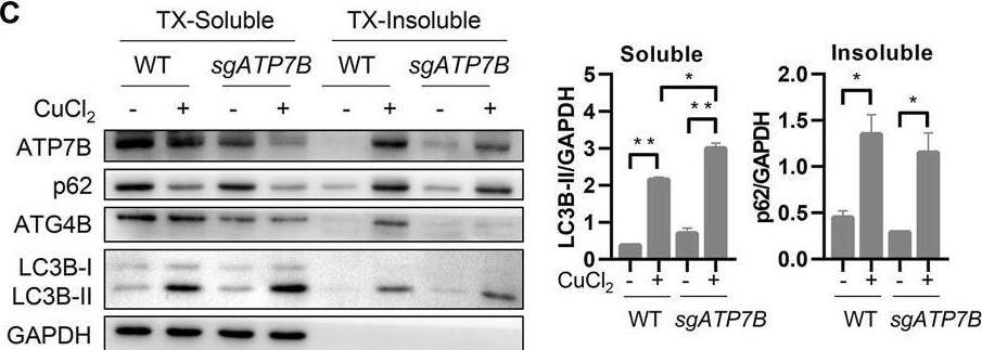 Copper contributes to the production of MB in Wilson disease through inhibiting autophagy. (A) Differential detergent fractionation was performed on WT HepG2 cells or GFP-Ctr1 HepG2 after treatment with 1 mM of copper ions for 6 h. Western blotting was carried out to detect the protein levels. (B) Colocalization analysis of the markers of MB such p62, K8/K18, and Ub before and after treatment of copper ions. The arrows mean colocalization. (C) Differential detergent fractionation was performed on WT HepaRG cells or ATP7B knockdown HepRG cells treated with 1 mM of copper ions for 6 h and western blotting was carried out to detect the protein levels. (D) Differential detergent fractionation followed by western blotting was performed on HepaRG cells treated with 1 mM of copper ions in the presence or absence of 40 μM of CQ for 6 h. (E) Differential detergent fractionation was performed on ATP7B knockdown HepRG cells treated with 1 mM of copper ions for 6 h and western blotting was carried out to detect the protein levels. (F) Densitometry analysis of protein bands of (E) was performed. The ratio of K8/K18 and LC3B in soluble fraction, p62 and ubiquitin in insoluble fraction was calculated. Image collected and cropped by CiteAb from the following open publication (//pubmed.ncbi.nlm.nih.gov/35349929), licensed under a CC-BY license. Not internally tested by Novus Biologicals.