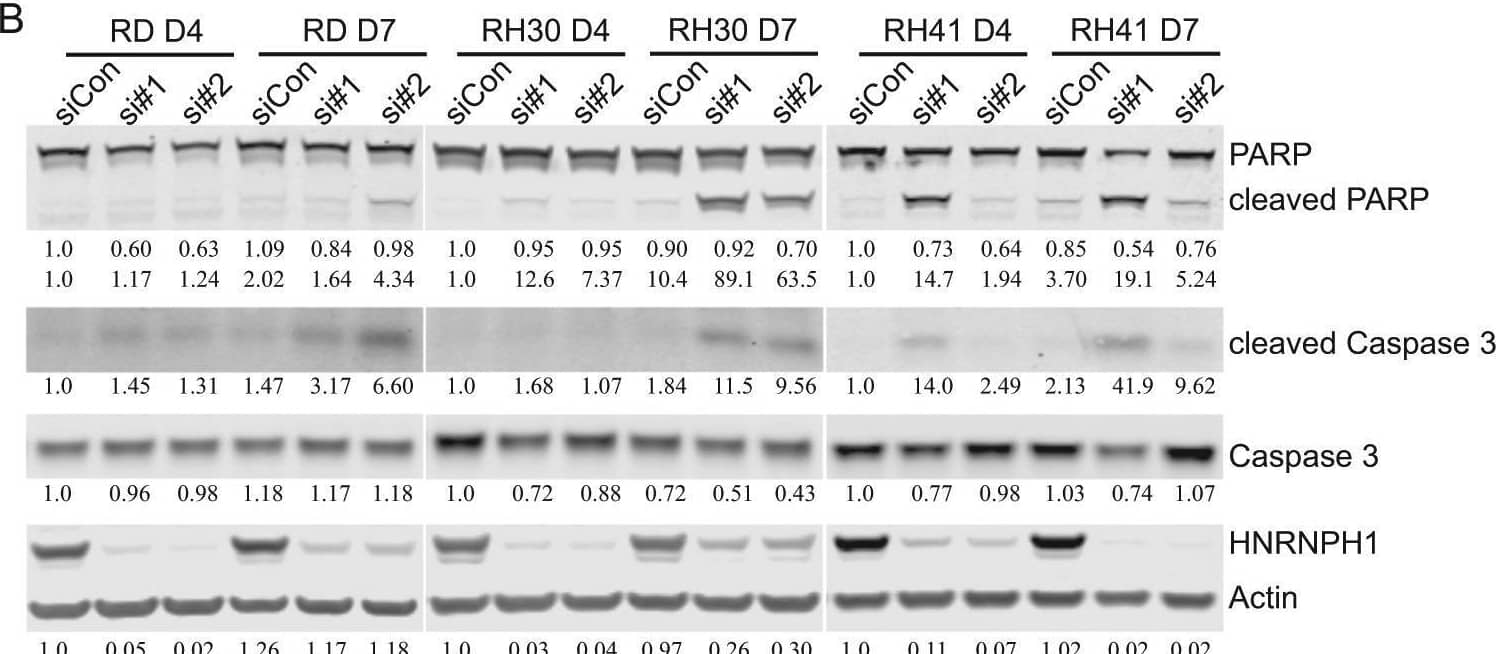 Knockdown of HNRNPH1 leads to decreased CDK2/4/6 protein levels and elevated apoptosis markers.a Immunoblot analysis of whole-cell lysates prepared from RMS cells (RD, RH30, and RH41) 2 and 4 days post-HNRNPH1 siRNA transfection with antibodies against CDK2/4/6, HNRNPH1, and  beta -actin. b Immunoblot analysis of whole-cell lysates prepared from RMS cells (RD, RH30, and RH41) 4 and 7 days post-HNRNPH1 siRNA transfection with antibodies against PARP, cleaved PARP, caspase-3, cleaved caspase-3, HNRNPH1, and  beta -actin. All quantification is shown below the gels and normalized to actin. CDK4 was quantified using the short exposure for RH30 cells Image collected and cropped by CiteAb from the following open publication (//pubmed.ncbi.nlm.nih.gov/29362363), licensed under a CC-BY license. Not internally tested by Novus Biologicals.