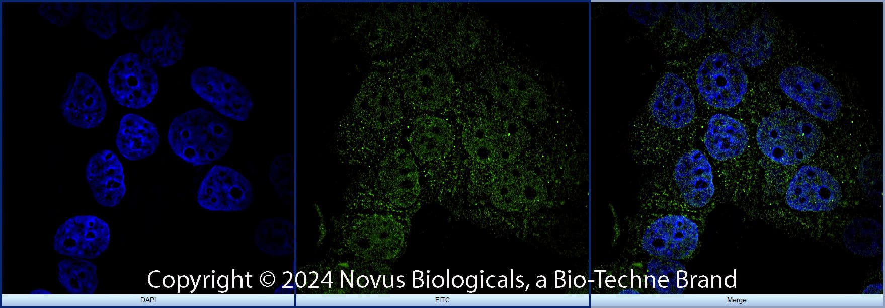 FoxP3 was detected in immersion fixed MCF7 human breast cancer cell line using Rabbit anti-FoxP3 Affinity Purified Polyclonal Antibody conjugated to DyLight 488 (Catalog # NB100-39002G) (green) at 10 µg/mL overnight at 4C. Cells were stained counterstained with DAPI (blue). Cells were imaged using a 100X objective and digitally deconvolved.