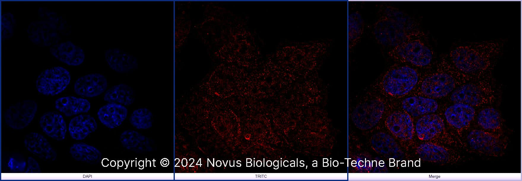 FoxP3 was detected in immersion fixed MCF7 human breast cancer cell line using Rabbit anti-FoxP3 Affinity Purified Polyclonal Antibody conjugated to DyLight 550 (Catalog # NB100-39002R) (red) at 10 µg/mL overnight at 4C. Cells were stained counterstained with DAPI (blue). Cells were imaged using a 100X objective and digitally deconvolved.