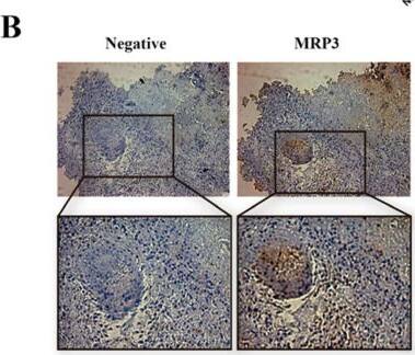 MRP3 expression in GSCs under hypoxic conditions. (A) MRP3 protein levels from GSCs under normoxia and hypoxia were analyzed by Western blot of GSCs. Bands were quantified and plotted.  beta -actin was used as a housekeeping control. (B) MRP3 expression was detected in human GBM samples by immunohistochemistry (scale bar 50 m). (C) Histograms represent fluorescence of CFDA accumulation (left) and plotted as fold of change of fluorescence (right). n = 3, * p < 0.05, ** p < 0.01, **** p < 0.0001, # p < 0.05 relative to hypoxia control. Image collected and cropped by CiteAb from the following open publication (//pubmed.ncbi.nlm.nih.gov/36012307), licensed under a CC-BY license. Not internally tested by Novus Biologicals.