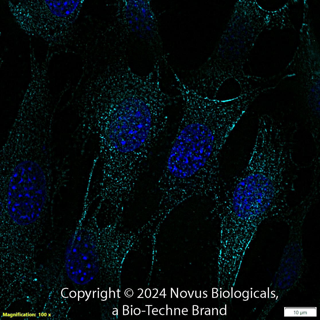 SLC31A1/CRT1 was detected in immersion fixed NIH3T3 Mouse fibroblast cell line using Rabbit anti-SLC31A1/CRT1 Antigen Affinity-purified Polyclonal Antibody conjugated to DyLight 650 (Catalog # NB100-402C) (light blue) at 10 µg/mL overnight at 4C.  Cells were counterstained with DAPI (blue). Cells were imaged using a 100X objective and digitally deconvolved.