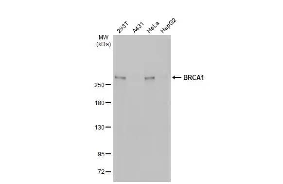 Western Blot: BRCA1 Antibody (6B4) [NB100-404] - Various whole cell extracts (30 ug) were separated by 5% SDS-PAGE, and the membrane was blotted with BRCA1 antibody [6B4] - ChIP grade (NB100-404) diluted at 1:500. The HRP-conjugated anti-mouse IgG antibody  was used to detect the primary antibody, and the signal was developed with Trident femto Western HRP Substrate.