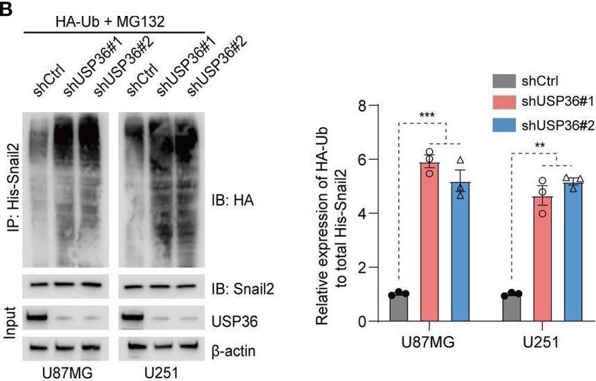 USP36 stabilizes Snail2 through deubiquitination. (A) Immunoblot showing Snail2 levels in HEK293T cells transfected with His-Snail2, HA-Ub and Flag-USP36-WT or Flag-USP36-C131A in the presence 20 μM MG132. Right panel, quantification results. (B) Immunoblot showing Snail2-Ub complexes precipitated by anti-His and probed with anit-HA, Snail2 and USP36 antibodies from GBM cells transfected with HA-Ub and shCtrl or sh-USP36. Right panel, quantification. (C, D) Snail2 ubiquitylation linkage in U87MG (C) and U251 (D) cells co-transfected with His-Snail2, Flag-USP36 and HA-Ub Lys0, Lys48-only, or Lys63-only plasmids. Right panel, quantification. (E, F) Immunoblot showing Snail2 levels in U87MG (E) and U251 (F) cells co-transfected with Ub-WT or Ub-Lys48R and shCtrl or shUSP36, with quantifications on right panel. **p < 0.01; ***p < 0.001. Image collected and cropped by CiteAb from the following open publication (//pubmed.ncbi.nlm.nih.gov/35111679), licensed under a CC-BY license. Not internally tested by Novus Biologicals.