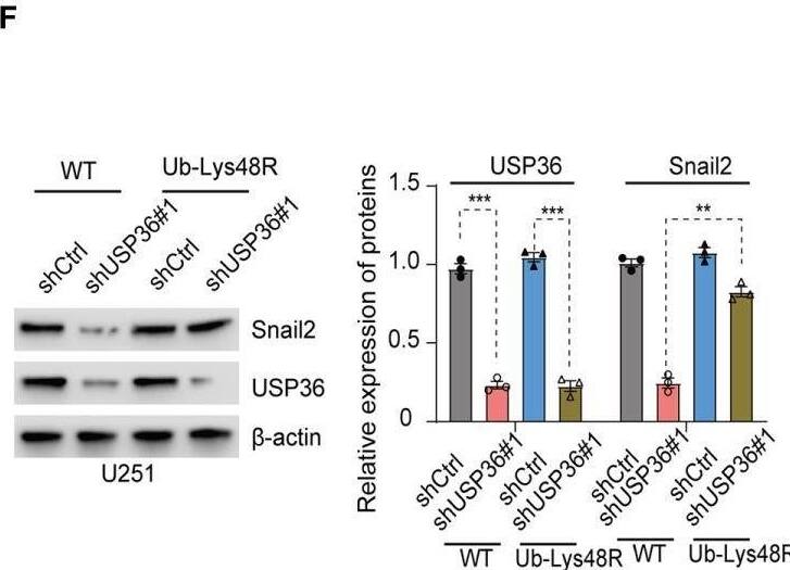 USP36 stabilizes Snail2 through deubiquitination. (A) Immunoblot showing Snail2 levels in HEK293T cells transfected with His-Snail2, HA-Ub and Flag-USP36-WT or Flag-USP36-C131A in the presence 20 μM MG132. Right panel, quantification results. (B) Immunoblot showing Snail2-Ub complexes precipitated by anti-His and probed with anit-HA, Snail2 and USP36 antibodies from GBM cells transfected with HA-Ub and shCtrl or sh-USP36. Right panel, quantification. (C, D) Snail2 ubiquitylation linkage in U87MG (C) and U251 (D) cells co-transfected with His-Snail2, Flag-USP36 and HA-Ub Lys0, Lys48-only, or Lys63-only plasmids. Right panel, quantification. (E, F) Immunoblot showing Snail2 levels in U87MG (E) and U251 (F) cells co-transfected with Ub-WT or Ub-Lys48R and shCtrl or shUSP36, with quantifications on right panel. **p < 0.01; ***p < 0.001. Image collected and cropped by CiteAb from the following open publication (//pubmed.ncbi.nlm.nih.gov/35111679), licensed under a CC-BY license. Not internally tested by Novus Biologicals.