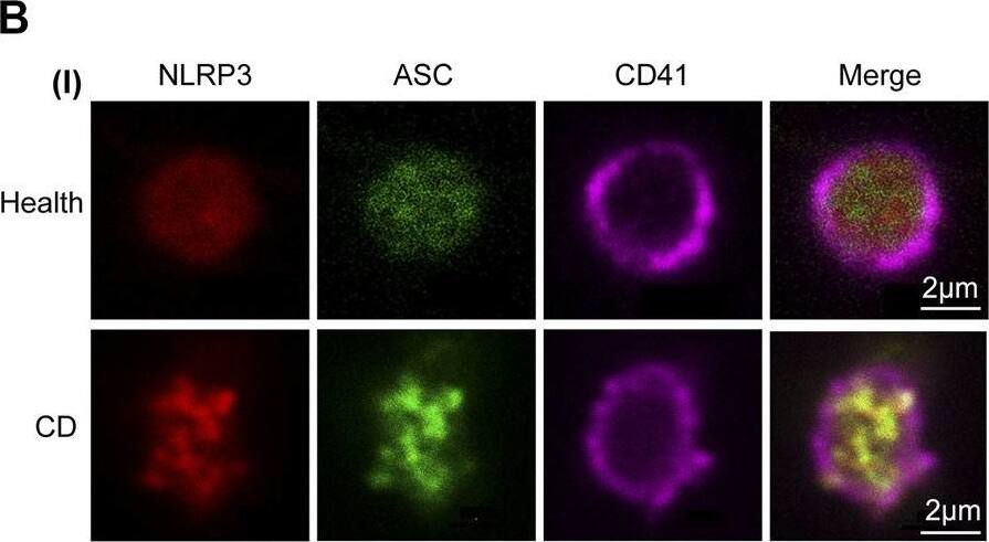 Activation of NLRP3 inflammasome in platelets from patients with active Crohn’s disease (CD). (A) Co-immunoprecipitation of ASC with NLRP3 in platelets from the healthy group and patients with active CD (i). Quantification of the interaction between ASC and NLRP3 in platelets was below (n = 3), (ii). (B) Immunofluorescence staining showed colocalization of ASC (green) and NLRP3 (red) in platelets from patients with active CD (i). The experiment was repeated three times. Intensity traces were plotted below (ii). Scale bars were 20 μm. Health, the healthy group; CD, the patients with active Crohn’s disease. Data are presented as mean +/- SD, ***p < 0.001. Image collected and cropped by CiteAb from the following open publication (//pubmed.ncbi.nlm.nih.gov/34262463), licensed under a CC-BY license. Not internally tested by Novus Biologicals.