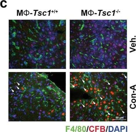 The activation of mTORC1 in KCs enhances complement alternative system.a Expression heatmap of genes of neutrophils chemotaxis or complement activation analyzed by RNA-seq from Tsc1+/+ and Tsc1-/- BMMs (n = 3 each). b Western blotting result was shown the expression of CFB protein in hepatic tissues from mice. c Left, representative co-immunofluorescent staining images for F4/80 with CFB. Scale bar = 50 μm. Right, quantitative determination of F4/80+ and CFB+ cells among groups as indicated, n = 3. d Western blotting assay showing the abundance for TSC1, CFB, and p-S6 in BMMs. e qRT-PCR analysis showing the CFB mRNA abundance in BMMs, n = 3. f Western blotting assay showing the abundance for TSC1, CFB, and p-S6 in KCs. g qRT-PCR analysis showing the CFB mRNA abundance in KCs, n = 3. h Representative immunofluorescent staining images for C3d. Scale bar = 50 μm. i Representative immunostaining images for C5b-9. Scale bar = 50 μm. j Western blotting assay showing the abundance for Rheb and CFB in BMMs. k Western blotting assay showing the abundance for Rheb and CFB in KCs. l Representative co-immunofluorescent staining images for F4/80 with CFB (white arrows). Scale bar = 100 μm. m Quantitative determination of F4/80+ and CFB+ cells among groups as indicated, n = 3. n Representative immunofluorescent staining images for C3d. Scale bar = 100 μm. o Representative immunostaining images for C5b-9 among groups as indicated. Scale bar = 100 μm. *p < 0.05. Image collected and cropped by CiteAb from the following open publication (//pubmed.ncbi.nlm.nih.gov/36494334), licensed under a CC-BY license. Not internally tested by Novus Biologicals.