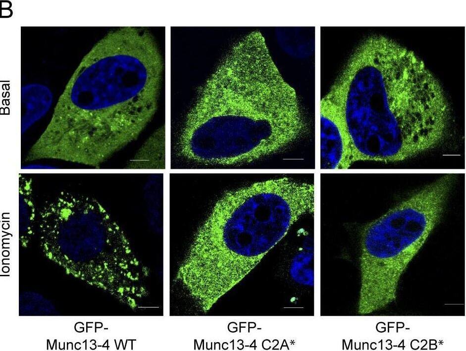 Munc13-4 translocation to membrane is Ca2+ dependent. (A) Live-cell epifluorescence imaging of GFP-Munc13-4 in MDA-MB-231 cells at indicated times after ionomycin stimulation. See Video 1. (B) MDA-MB-231 cells expressing wild-type GFP-Munc13-4, GFP-Munc13-4 C2A*, or GFP-Munc13-4 C2B* either left untreated or stimulated with 1.25 uM ionomycin for 5 min were fixed and imaged by confocal microscopy. (C) Indicated proteins were detected by SDS-PAGE and Western blotting of lysates with Munc13-4 antibody from MDA-MB-231 cells stably expressing control shRNA (Ctrl) or shRNA targeting Munc13-4 (KD), or Munc13-4 KD cells rescued with shRNA-resistant wild-type Munc13-4, Munc13-4 C2A*, or Munc13-4 C2B*. (D) Culture media supernatants (as in Fig. 1 B) from MDA-MB-231 cells as in C either untreated or stimulated with 1.25 uM ionomycin for 30 min were filtered onto membrane and analyzed for CD63 or GM130. (E) Quantification of CD63+ exosome release (from Fig 1 D) shown as mean values +/- SE for n = 3. *, P < 0.05 for comparison between ionomycin-treated and basal. Bars, 5 μm. Image collected and cropped by CiteAb from the following open publication (//pubmed.ncbi.nlm.nih.gov/29930202), licensed under a CC-BY license. Not internally tested by Novus Biologicals.