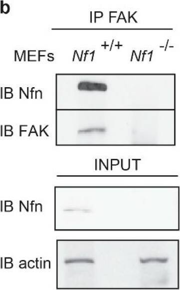Western Blot Neurofibromin 1 Antibody - BSA Free