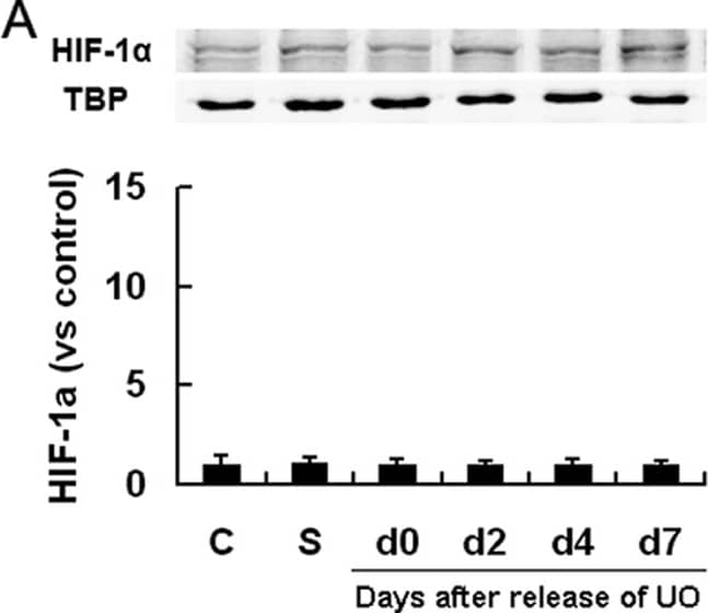 Western Blot: HIF-1 alpha Antibody - BSA Free [NB100-479] - Effect of 24 h UO on renal HIF-1 alpha /2 alpha  expression.WT mice were exposed to either sham-operation or left UO, which continued for 24 hours, & then was released. The left kidneys were harvested immediately (d0), 2, 4 or 7 days after release of obstruction (n = 4 at each time point). Immunoblot analyses of HIF-1 alpha  & HIF-2 alpha  in left kidneys were then performed & co-detection of TBP was performed to assess equal loading. HIF protein bands were quantified & normalized to TBP. Data were expressed as mean ± SD, & the mean value obtained from non-operated control mice was arbitrarily defined as 1. *, p<0.05 versus sham-operated controls; **, p<0.05 versus all the other groups. C, non-operated controls; S, sham-operated controls. Image collected & cropped by CiteAb from the following publication (//pubmed.ncbi.nlm.nih.gov/22295069), licensed under a CC-BY license. Not internally tested by Novus Biologicals.
