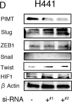 Western Blot: HIF-1 alpha Antibody - BSA Free [NB100-479] - Increased expression of HIF alpha  and/or Twist in A549 & H441 cells induced by the inhibition of PIMT & Thapsigargin(A) Immunoblotting of Slug, ZEB1, Snail1, Twist, & HIF1 alpha  in A549 sh-PIMT & sh-control cells. (B, C) Immunoblotting & relative intensity of HIF1 alpha  in A549 cells treated with Tg. (D) Immunoblotting of Slug, ZEB1, Snail1, Twist, & HIF1 alpha  in si-control cells & si-PIMT H441 cells. (E, F) Immunoblotting & relative intensity of HIF1 alpha  in H441 cells treated with Tg. #1 & #2 indicates si-RNA of J-010000-05-0002 & J-010000-07-0002, respectively. Image collected & cropped by CiteAb from the following publication (//www.oncotarget.com/lookup/doi/10.18632/oncotarget.24324), licensed under a CC-BY license. Not internally tested by Novus Biologicals.