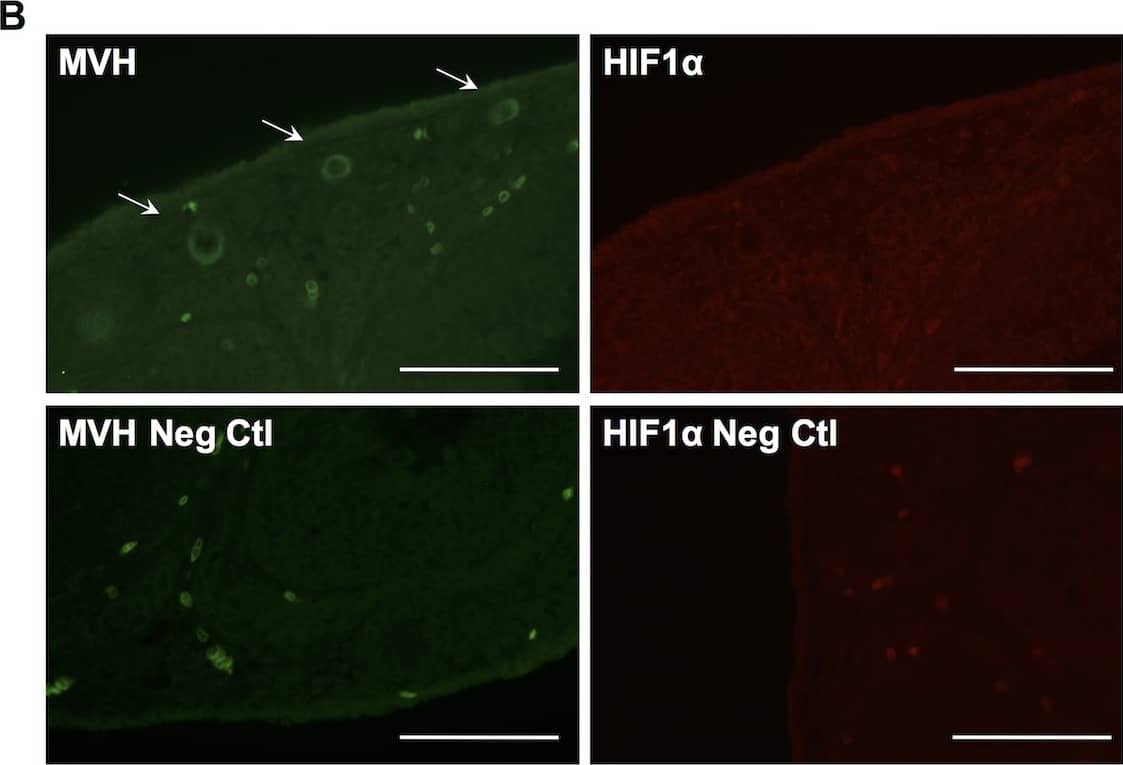 Immunocytochemistry/ Immunofluorescence: HIF-1 alpha Antibody - BSA Free [NB100-479] - Hif1 alpha  expression in neonatal & adult ovary.(A) Section of P5 ovary showing MVH expression in all oocytes & Hif1 alpha  expression only in small oocytes (primary follicles; top). Negative control images without primary antibodies (bottom). Scale bar: 50μm. (B) Section of adult ovary showing absence of Hif1 alpha  expression in primary follicles detected with MVH staining (top). Negative control without primary antibody (bottom). Scale bar: 50μm. (C) Section of adult ovary showing Hif1 alpha  expression in mature primary oocyte (arrow). Negative control without primary antibody (bottom). Scale bar: 100μm. (D) Image of a Metaphase II oocyte from superovulated three-month-old female showing Hif1 alpha  expression. Scale bar: 50μm. Image collected & cropped by CiteAb from the following publication (//pubmed.ncbi.nlm.nih.gov/27148974), licensed under a CC-BY license. Not internally tested by Novus Biologicals.