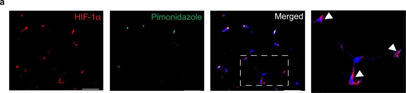 Immunocytochemistry/ Immunofluorescence: HIF-1 alpha Antibody - BSA Free [NB100-479] - (a) Immunofluorescence staining for HIF-1 alpha  (red), hypoxia probe pimonidazole (green) & DAPI nuclei (blue) in WAT of obese mice. Boxed region in the merged image shows HIF-1 alpha -positive cells in crown-like structures that are Pimo− (arrows). (b) HIF-1 alpha  protein levels in BMDM treated with BSA (control) or BSA-conjugated palmitate (Palm) for 6, 12 & 24 hours. Tubulin is shown as an internal loading control. (c) Fold change in mRNA expression of Hif1a, Vegfa & Il1b in BMDM treated with palmitate or BSA. (d) Relative mRNA expression in BMDM treated as indicated  in the presence or absence of a HIF-1 alpha  inhibitor. Data are representative of 3 independent experiments & are expressed as mean ± s.e.m. *p < 0.05. Image collected & cropped by CiteAb from the following publication (//pubmed.ncbi.nlm.nih.gov/32221369), licensed under a CC-BY license. Not internally tested by Novus Biologicals.