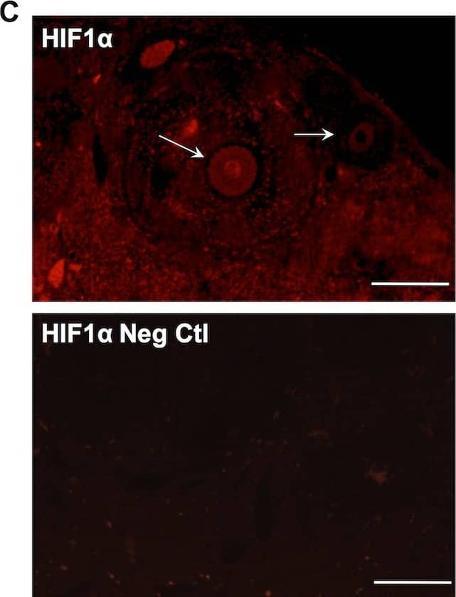 Immunocytochemistry/ Immunofluorescence: HIF-1 alpha Antibody - BSA Free [NB100-479] - Hif1 alpha  expression in neonatal & adult ovary.(A) Section of P5 ovary showing MVH expression in all oocytes & Hif1 alpha  expression only in small oocytes (primary follicles; top). Negative control images without primary antibodies (bottom). Scale bar: 50μm. (B) Section of adult ovary showing absence of Hif1 alpha  expression in primary follicles detected with MVH staining (top). Negative control without primary antibody (bottom). Scale bar: 50μm. (C) Section of adult ovary showing Hif1 alpha  expression in mature primary oocyte (arrow). Negative control without primary antibody (bottom). Scale bar: 100μm. (D) Image of a Metaphase II oocyte from superovulated three-month-old female showing Hif1 alpha  expression. Scale bar: 50μm. Image collected & cropped by CiteAb from the following publication (//pubmed.ncbi.nlm.nih.gov/27148974), licensed under a CC-BY license. Not internally tested by Novus Biologicals.