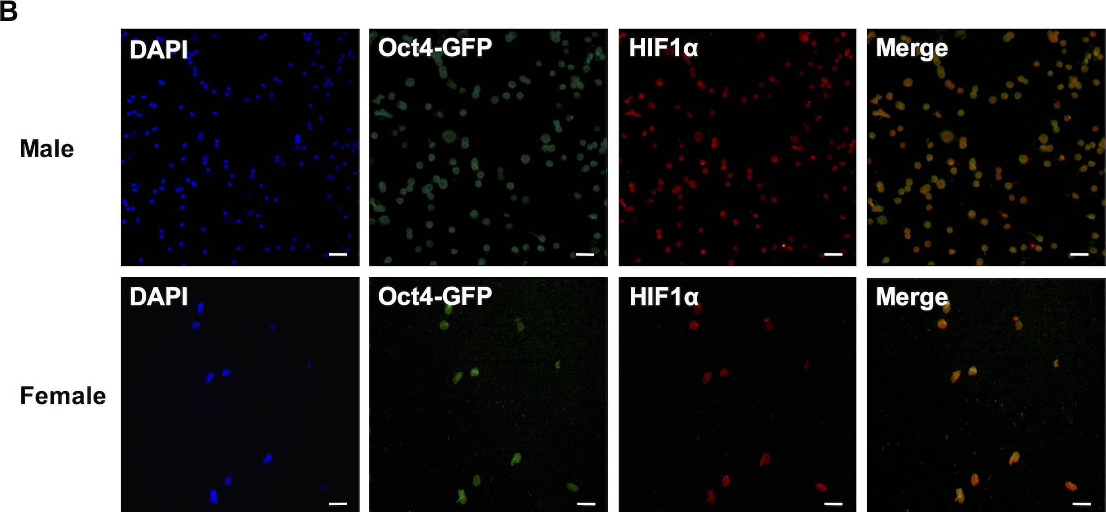 Immunocytochemistry/ Immunofluorescence: HIF-1 alpha Antibody - BSA Free [NB100-479] - Hif1 alpha  expression in 15.5dpc germ cells.(A) Sections of male (top) & female (bottom) gonads from 15.5 dpc Oct4-GFP embryos showing Oct4-GFP & Hif1 alpha  expressions in germ cells. Scale bars: 50μm (male) & 20μm (female). (B) FACS-sorted male (top) & female (bottom) 15.5dpc germ cells showing Oct4-GFP & Hif1 alpha  expressions. Scale bars: 100μm (male) & 50μm (female). Image collected & cropped by CiteAb from the following publication (//pubmed.ncbi.nlm.nih.gov/27148974), licensed under a CC-BY license. Not internally tested by Novus Biologicals.