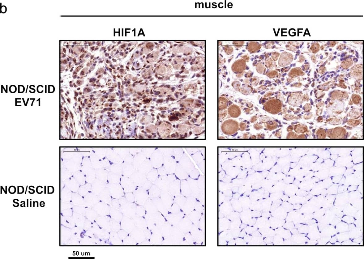 Immunohistochemistry: HIF-1 alpha Antibody - BSA Free [NB100-479] - White-jaded spleen & muscle in another NOD/SCID mouse model. One-week-old NOD/SCID mice were i.p. infected with EV-A71, & scarified after disease manifestation. aUpper panel: An atrophic & discolored spleen was identified in EV-A71-infected mice. Viral protein (VP1) & HIF1A were both expressed in the infected spleen. Lower panel: A saline control showed a normal-sized spleen with no VP1 & less expression of HIF1A. b Both HIF1A & VEGFA were strongly expressed in the whitened muscles infected with EV-A71, but not detectable in the saline control Image collected & cropped by CiteAb from the following publication (//pubmed.ncbi.nlm.nih.gov/31711481), licensed under a CC-BY license. Not internally tested by Novus Biologicals.
