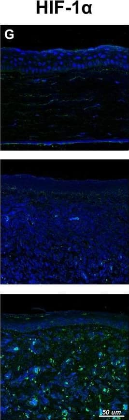 Immunocytochemistry/ Immunofluorescence: HIF-1 alpha Antibody - BSA Free [NB100-479] - Histology & immunofluorescence in rat corneal sections. a Hematoxylin & Eosin (H&E), b VEGF-A (green); c CCL2 (green); d TNF-alpha  (green); e CXCL5 (green); f CD45 (green) & g HIF-1 alpha  (green) staining in rat cornea tissue. Nuclear counterstaining by DAPI (blue) in fluorescent images Image collected & cropped by CiteAb from the following publication (//link.springer.com/10.1007/s10456-018-9594-9), licensed under a CC-BY license. Not internally tested by Novus Biologicals.