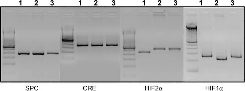 Western Blot: HIF-1 alpha Antibody - BSA Free [NB100-479] - Genotyping of transgenes.PCR genotyping was performed for all four transgenes as described in materials & methods. Sizes of the amplified products obtained are: 240 bp for Hif-1 alpha  (wild type); 274 bp for Hif-1 alpha flox/flox; 410 bp for Hif-2 alpha  (wild type); 444bp for Hif-2 alpha flox/flox; 370 bpfor Cre transgene; 350 bpfor rtTA transgene. One representative sample was genotyped for the four transgenes from each of three generated mouse strains: SPC-rtTA-/tg/(tetO)7-Cre-/tg/Hif-1 alpha fl/fl (Lane 1), SPC-rtTA-/tg/(tetO)7-Cre-/tg/Hif-2 alpha fl/fl mouse (Lane 2), & SPC-rtTA-/tg/(tetO)7-Cre-/tg/Hif-1 alpha /2 alpha fl/fl (Lane 3)). Image collected & cropped by CiteAb from the following publication (//dx.plos.org/10.1371/journal.pone.0139270), licensed under a CC-BY license. Not internally tested by Novus Biologicals.