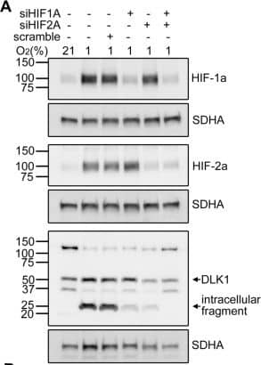 Western Blot: HIF-1 alpha Antibody - BSA Free [NB100-479] - DLK1 cleavage is dependent on HIFs & ADAM 17 activity.a, b Representative images & densitometric analysis of western blots showing HIF-1 alpha , HIF-2 alpha , & DLK1 expression & cleavage in U3082MG cells after siRNA targeting of HIF1A & HIF2A in hypoxia. c, d Representative images & densitometric analysis of western blots showing the effects of ADAM inhibition by pre-treatment with 20 µM TAPI-2 on DLK1 cleavage in U3082MG cells grown at 21% or 1% O2 for 48 h. SDHA was used as loading control. e, f Representative images & densitometric analysis of western blots showing the effects of ADAM17 inhibition by pre-treatment with 0.5 μM TMI-1 on DLK1 cleavage in U3082MG cells grown at 21% or 1% O2 for 48 h. SDHA was used as loading control. Statistical analysis: b has 3 independent experiments while d & f have four independent experiments, all data are expressed as mean ± SEM. Statistical significance was determined by one-way ANOVA, followed by Bonferroni post hoc test. In the whole figure significance is represented as *p < 0.05, **p < 0.01, & ***p < 0.001 vs. respective 21% O2 controls or as indicated by straight lines. Image collected & cropped by CiteAb from the following publication (//pubmed.ncbi.nlm.nih.gov/32205867), licensed under a CC-BY license. Not internally tested by Novus Biologicals.