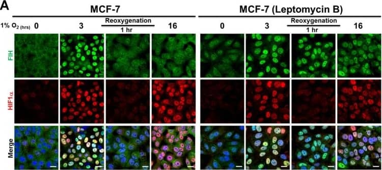 Immunocytochemistry/ Immunofluorescence: HIF-1 alpha Antibody - BSA Free [NB100-479] - FIH exits the nucleus via a Leptomycin B-sensitive exportin1-dependent pathway. (A) Immunofluorescence staining of FIH (green) & HIF1 alpha  (red) in MCF7 cells after the indicated hypoxia (0.5% O2) & re-oxygenation treatments. TO-PRO-3 (blue) was used to stain nuclei. (B) Total cell lysates from U2OS cells were immunoprecipitated with an anti-exportin1 antibody or control IgG. FIH, exportin1 &  beta -tubulin levels are indicated. (C) Immunofluorescence staining of FIH (green) in FIH-null mouse embryonic fibroblasts (MEFs) transfected with HA-FIH 1–349 or HA-FIH  delta NES followed by normoxia, hypoxia (1% O2, 3 h) or 3 h of hypoxia followed by re-oxygenation for 1 h. TO-PRO-3 (blue) was used to stain nuclei. Arrows indicate nuclear localization of signal. (D) Total cell lysates from U2OS cells transfected with control vector, HA-FIH 1–349 or HA-FIH  delta NES were immunoprecipitated with an anti-exportin 1 antibody. HA-FIH, exportin1 &  beta -tubulin levels are indicated. FL, full length; IgGL, IgG light chain. Scale bars: 20 µm. Image collected & cropped by CiteAb from the following publication (//pubmed.ncbi.nlm.nih.gov/30333145), licensed under a CC-BY license. Not internally tested by Novus Biologicals.
