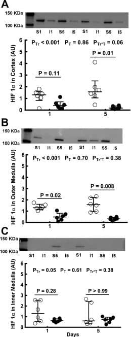 Western Blot: HIF-1 alpha Antibody - BSA Free [NB100-479] - Expression of hypoxia-inducible factor (HIF) proteins after bilateral renal ischemia or sham ischemia. Immunoblots for HIF-1 alpha  (A–C) & HIF-2 alpha  (D–F) of tissue extracts from the cortex & outer & inner medulla of the left kidneys of rats 24 h & 5 days following recovery from either sham ischemia (○) or bilateral renal ischemia (●); n = 6 per group. G: typical image of the gel following electrophoresis. H: typical image of the nitrocellulose membrane following transfer. Values are expressed as medians (25th percentile, 75th percentile). Paired comparisons were performed using the Mann-Whitney U-test. Because paired comparisons were made at two time points, P values were conservatively adjusted using the Dunn-Sidak method with k = 2. PTr, PT, & PTr*T are the outcomes of two-way analysis of variance on ranking with the factors treatment (Tr) & time (T). AU, arbitrary unit; I1, 24 h after ischemia; I5, 5 days after ischemia; S1, 24 h after sham ischemia; S5, 5 days after sham ischemia. Image collected & cropped by CiteAb from the following publication (//pubmed.ncbi.nlm.nih.gov/30110566), licensed under a CC-BY license. Not internally tested by Novus Biologicals.