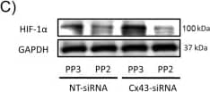 Western Blot: HIF-1 alpha Antibody - BSA Free [NB100-479] - Effect of ET-1 & Cx43 on HIF-1 alpha  expression & glucose uptake when c-Src is inhibited.Astrocytes were preincubated with 100 ng/µL PP2 (c-Src inhibitor) or 100 ng/µL PP3 (inactive analogue) for 1 h. Then, cells were incubated in the absence (control) or presence of 0.1 µM ET-1 for 24 h. A) HIF-1 alpha  Western blot & quantification. The results are expressed as percentages of the level found in the controls treated with PP3 & they show that the inhibitor of c-Src PP2 prevented the up-regulation of HIF-1 alpha  promoted by ET-1. ***p<0.001 versus the absence of ET-1. B) Glucose uptake expressed as pmol of 2-deoxyglucose taken up per hour & per milligram of protein. The results show that the inhibitor of c-Src PP2 prevented the increase in the rate of glucose uptake promoted by ET-1. ***p<0.001 versus the absence of ET-1. C) Astrocytes were preincubated with 100 ng/µL PP2 or 100 ng/µL PP3 for 1 h. Then, cells were transfected with NT-siRNA or with Cx43-siRNA & after 48 h HIF-1 alpha  was analysed by Western blot. The results are expressed as percentages of the level found in the PP3 NT-siRNA & they show that the inhibitor of c-Src PP2 prevented the up-regulation of HIF-1 alpha  promoted by silencing Cx43. ***p<0.001 versus the corresponding NT-siRNA. Image collected & cropped by CiteAb from the following publication (//dx.plos.org/10.1371/journal.pone.0032448), licensed under a CC-BY license. Not internally tested by Novus Biologicals.