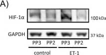 Western Blot: HIF-1 alpha Antibody - BSA Free [NB100-479] - Effect of ET-1 & Cx43 on HIF-1 alpha  expression & glucose uptake when c-Src is inhibited.Astrocytes were preincubated with 100 ng/µL PP2 (c-Src inhibitor) or 100 ng/µL PP3 (inactive analogue) for 1 h. Then, cells were incubated in the absence (control) or presence of 0.1 µM ET-1 for 24 h. A) HIF-1 alpha  Western blot & quantification. The results are expressed as percentages of the level found in the controls treated with PP3 & they show that the inhibitor of c-Src PP2 prevented the up-regulation of HIF-1 alpha  promoted by ET-1. ***p<0.001 versus the absence of ET-1. B) Glucose uptake expressed as pmol of 2-deoxyglucose taken up per hour & per milligram of protein. The results show that the inhibitor of c-Src PP2 prevented the increase in the rate of glucose uptake promoted by ET-1. ***p<0.001 versus the absence of ET-1. C) Astrocytes were preincubated with 100 ng/µL PP2 or 100 ng/µL PP3 for 1 h. Then, cells were transfected with NT-siRNA or with Cx43-siRNA & after 48 h HIF-1 alpha  was analysed by Western blot. The results are expressed as percentages of the level found in the PP3 NT-siRNA & they show that the inhibitor of c-Src PP2 prevented the up-regulation of HIF-1 alpha  promoted by silencing Cx43. ***p<0.001 versus the corresponding NT-siRNA. Image collected & cropped by CiteAb from the following publication (//dx.plos.org/10.1371/journal.pone.0032448), licensed under a CC-BY license. Not internally tested by Novus Biologicals.