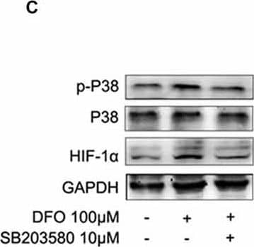 Western Blot: HIF-1 alpha Antibody - BSA Free [NB100-479] - Roles of P38 mitogen-activated protein kinase (MAPK) in the DFO-mediated up-regulate of HIF-1 alpha  protein in APPsw cells. (A) APPsw were exposed to 100 μM Fe, 100 μM DFO, or both combined for 24 h. Whole cell lysates were prepared & subjected to analysis for P38 or GAPDH protein. (B) Western blot analysis revealed that strong phosphorylation of P38 MAPK was detected in the DFO-treated cells, whereas no significant changes were observed in cells treated Fe alone compared with control. There were not statistical changes in the levels of P38 MAPK among the groups. The data represent the mean ± S.E. of three independent experiments. *p < 0.05, **p < 0.01 compared with the control; #p < 0.05, ##p < 0.01 with respect to the Fe treatment group. (C–E) APPsw cells were pretreated without or with SB203580 (10 μM) for 2 h & then treated without or with DFO for additional 22 h in the absence or presence of the inhibitor. Immunoblotting showed that DFO treatment significantly increased the levels of p-P38 MAPK compared with the control group, whereas the increase was significantly ameliorated by SB203580. Furthermore, the DFO-mediated up-regulation of HIF-1 alpha  protein was greatly inhibited by SB203580. The data represent the mean ± S.E. (n = 3). **p < 0.01 compared with the control; ##p < 0.01 compared to the values of DFO treatment group (two-way ANOVA with Post hoc Fisher’s PLSD). Image collected & cropped by CiteAb from the following publication (//pubmed.ncbi.nlm.nih.gov/26082716), licensed under a CC-BY license. Not internally tested by Novus Biologicals.