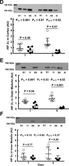 Western Blot: HIF-1 alpha Antibody - BSA Free [NB100-479] - Expression of hypoxia-inducible factor (HIF) proteins after bilateral renal ischemia or sham ischemia. Immunoblots for HIF-1 alpha  (A–C) & HIF-2 alpha  (D–F) of tissue extracts from the cortex & outer & inner medulla of the left kidneys of rats 24 h & 5 days following recovery from either sham ischemia (○) or bilateral renal ischemia (●); n = 6 per group. G: typical image of the gel following electrophoresis. H: typical image of the nitrocellulose membrane following transfer. Values are expressed as medians (25th percentile, 75th percentile). Paired comparisons were performed using the Mann-Whitney U-test. Because paired comparisons were made at two time points, P values were conservatively adjusted using the Dunn-Sidak method with k = 2. PTr, PT, & PTr*T are the outcomes of two-way analysis of variance on ranking with the factors treatment (Tr) & time (T). AU, arbitrary unit; I1, 24 h after ischemia; I5, 5 days after ischemia; S1, 24 h after sham ischemia; S5, 5 days after sham ischemia. Image collected & cropped by CiteAb from the following publication (//pubmed.ncbi.nlm.nih.gov/30110566), licensed under a CC-BY license. Not internally tested by Novus Biologicals.
