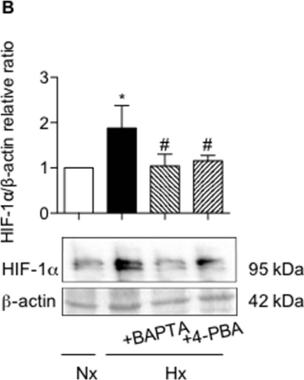 Western Blot: HIF-1 alpha Antibody - BSA Free [NB100-479] - Involvement of HIF-1 alpha  in alveolar epithelial cell phenotypic changes induced by hypoxia. Primary rat AECs were cultured in normoxia (Nx) (21% O2) or hypoxia (Hx) (1.5% O2) during 6 days in presence or absence of 10 µM YC-1. (A) Immunostaining of ZO-1 (magenta) & TTF1 (cyan) were performed. n = 4 experiments were performed. Isolated primary rat AECs were cultured in normoxia (Nx) (21% O2) or hypoxia (Hx) (1.5% O2) during 6 h in the presence or absence of 100 mM 4-phenylbutyrate (4-PBA) or pre-treated or not with 1 µM BAPTA-AM 90 min before exposition to hypoxia. A representative picture of at least n = 4 independent experiments for each condition has been presented & scale bar represents 50 µm. (B) Western blot of HIF-1 alpha  protein levels was performed. Representative blot of n = 5 experiments is shown. Expression levels of HIF-1 alpha  were quantified & reported to  beta -actin expression for each condition. Primary rat AECs were transfected with plasmid coding for luciferase reporter activity of hypoxia responsive element (HRE: i.e., HIF-luc), & cultured as described. (C) Luciferase activity corresponding to the transcriptional capacity of HIF was reported (n = 4 experiments). Raw data were submitted a Kruskal-Wallis test. * & ** indicate a significant difference as compared with normoxic value with p < 0.05 & p < 0.01 respectively. # & ## indicate a significant difference as compared with value in untreated hypoxic cells with p < 0.05 & p < 0.01, respectively. Image collected & cropped by CiteAb from the following publication (//pubmed.ncbi.nlm.nih.gov/30875855), licensed under a CC-BY license. Not internally tested by Novus Biologicals.