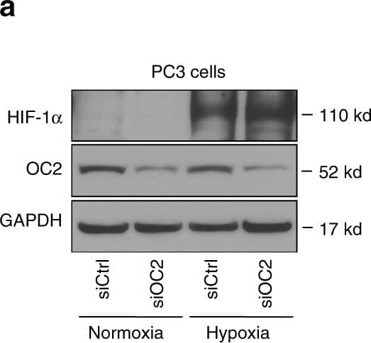 Western Blot: HIF-1 alpha Antibody - BSA Free [NB100-479] - ONECUT2 modulates HIF1 alpha  binding to chromatin in NE-like PC3 cells. a Western blot of HIF1 alpha  & ONECUT2 in PC3 cells under normoxic & hypoxic conditions. Two different siRNAs targeting ONECUT2 were mixed together for knockdown experiments. b Left panel: heatmaps show HIF1 alpha  ChIP-Seq signal in PC3 cells under hypoxic conditions with & without knockdown of ONECUT2; right panel: pileup of HIF1 alpha  ChIP-Seq signals centered at HIF1 alpha  ChIP-Seq peaks center. c Expression of ANGPTL4 & ADM, two hypoxia-regulated genes, with & without knockdown of ONECUT2 in PC3 cells. d Schematic illustration of the analysis identifying SMAD3 as an ONECUT2 regulated HIF1 alpha  co-factor. Genes identified in motifs enriched in HIF1 alpha  binding sites & ONECUT2 target genes were further filtered by HIF1 alpha  interacting protein list from BioGRID. ONECUT2 target genes were defined as differentially expressed in ONECUT2 knockdown & control samples & with ONECUT2 binding sites nearby in PC3 cells under hypoxic conditions. e SMAD3 expression in response to ONECUT2 silencing in PC3 cells. f SMAD3 & HIF1 alpha  binding sites with & without silencing of SMAD3. g The overlap of SMAD3 ChIP-Seq, HIF1 alpha  ChIP-Seq & SMAD3-HIF1 alpha  ChIP-re-ChIP-Seq peaks. h SMAD3 ChIP-Seq, HIF1 alpha  ChIP-Seq & SMAD3-HIF1 alpha  ChIP-re-ChIP-Seq signal near the promoter regions of hypoxia-induced genes ANGPTL4 & ADM. Error bars indicate s.d. from at least two technical replicates. P-value is calculated by one-way ANOVA. **: P < 0.01. Source data are provided as a Source Data file Image collected & cropped by CiteAb from the following publication (//pubmed.ncbi.nlm.nih.gov/30655535), licensed under a CC-BY license. Not internally tested by Novus Biologicals.