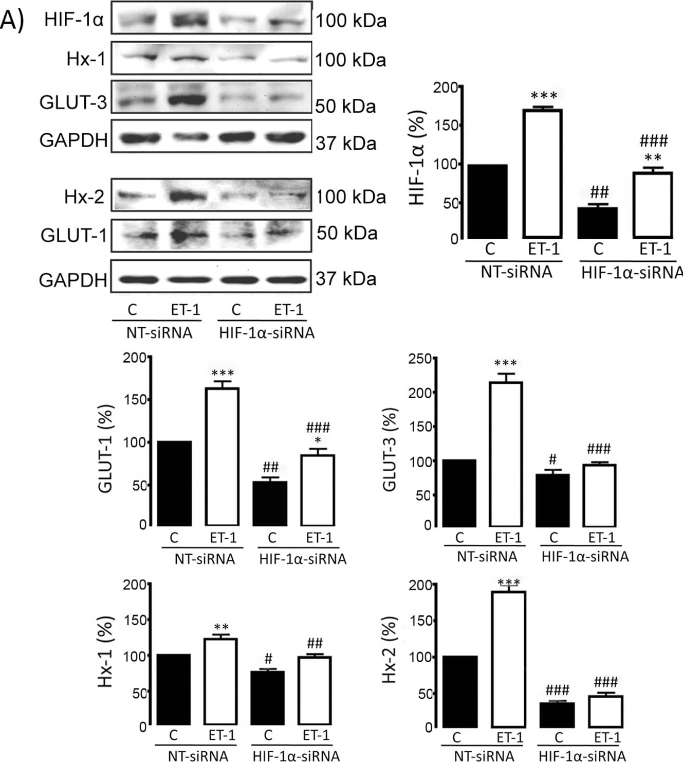 Western Blot: HIF-1 alpha Antibody - BSA Free [NB100-479] - Effect of ET-1 on glucose uptake in HIF-1 alpha -silenced astrocytes.Astrocytes were transfected with NT-siRNA or with HIF-1 alpha -siRNA. After 48 h, astrocytes were incubated in the absence (control, C) or presence of 0.1 µM ET-1 for 24 h. A) HIF-1 alpha , Hx-1, GLUT-3, Hx-2, GLUT-1 & GAPDH Western blots & quantification. The results are the means ± SEM of at least three independent experiments & they are expressed as percentages of the level found in the control NT-siRNA. B) Glucose uptake expressed as pmol of 2-deoxyglucose (2-DG) taken up per hour & per milligram of protein. The results show that the down-regulation of HIF-1 alpha  levels promoted by HIF-1 alpha -siRNA decreased the rate of glucose uptake & the expression of GLUT-1, GLUT-3, Hx-1 & Hx-2, both in the control & in the ET-1 treated astrocytes. ***p<0.001, **p<0.01 & *p<0.05 versus the corresponding controls (C); ###p<0.001, ##p<0.01 & #p<0.05 versus the corresponding NT-siRNA. Image collected & cropped by CiteAb from the following publication (//dx.plos.org/10.1371/journal.pone.0032448), licensed under a CC-BY license. Not internally tested by Novus Biologicals.