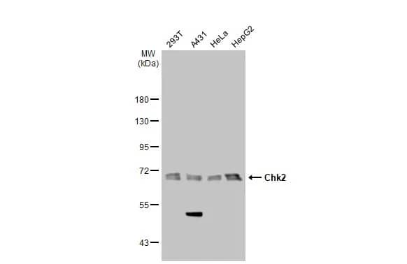 Western Blot: Chk2 Antibody (8F12) [NB100-500] - Various whole cell extracts (30 ug) were separated by 10% SDS-PAGE, and the membrane was blotted with Chk2 antibody [8F12] (NB100-500) diluted at 1:500. The HRP-conjugated anti-mouse IgG antibody  was used to detect the primary antibody, and the signal was developed with Trident ECL plus-Enhanced.