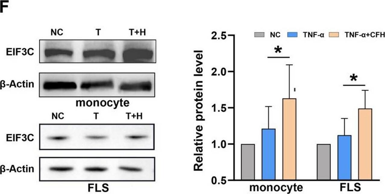 EIF3C is a potential target for CFH to play a role in inhibiting FLSs and monocyte function. Monocytes and FLS from RA patients were selected respectively, and cells from each patient were divided into two groups. One group was left untreated, and one group was treated with 5 μg/ml CFH for 6 h. A Volcano plot indicated up-regulated (red dots) and down-regulated (blue dots) genes (P value  0.5) by RNA sequencing in CFH-treated versus untreated RA monocytes. EIF3C is indicated. B Volcano plot indicated up-regulated (red dots) and down-regulated (blue dots) genes (P value  0.5) by RNA sequencing in CFH-treated versus untreated RA monocytes. EIF3C and EIF3CL are indicated. C We selected the genes upregulated in the CFH-treated monocytes and the genes upregulated in the CFH-treated FLS identified by RNA-sequencing and determined the intersecting proteins. We obtained one gene, namely EIF3C. DEGs: Differentially Expressed Genes. D The boxplot shows the relative expression of EIF3C and EIF3CL. E CFH upregulated the protein expression of EIF3C by using Western blot. F CFH combined with TNF-alpha  upregulated protein expression of EIF3C in both RA FLSs and monocytes by using Western blot. Data are expressed as mean +/- SEM (n = 6). *p  0.5) by RNA sequencing in CFH-treated versus untreated RA monocytes. EIF3C is indicated. B Volcano plot indicated up-regulated (red dots) and down-regulated (blue dots) genes (P value  0.5) by RNA sequencing in CFH-treated versus untreated RA monocytes. EIF3C and EIF3CL are indicated. C We selected the genes upregulated in the CFH-treated monocytes and the genes upregulated in the CFH-treated FLS identified by RNA-sequencing and determined the intersecting proteins. We obtained one gene, namely EIF3C. DEGs: Differentially Expressed Genes. D The boxplot shows the relative expression of EIF3C and EIF3CL. E CFH upregulated the protein expression of EIF3C by using Western blot. F CFH combined with TNF-alpha  upregulated protein expression of EIF3C in both RA FLSs and monocytes by using Western blot. Data are expressed as mean +/- SEM (n = 6). *p < 0.05 Image collected and cropped by CiteAb from the following open publication (//pubmed.ncbi.nlm.nih.gov/37996918), licensed under a CC-BY license. Not internally tested by Novus Biologicals.