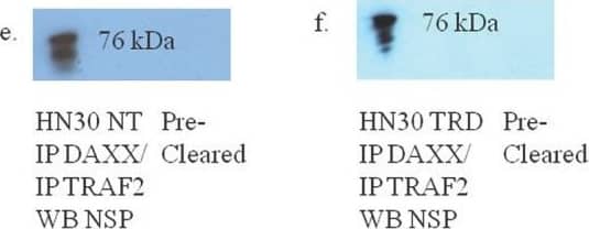 Western Blot: NSP 5 alpha 3 alpha Antibody [NB100-517] - Western blot analysis of co-immunoprecipitations of asynchronous HN30 non-treated & HN30 cells transfected with pcDNA 3.0 NSP 5a3a & pcDNA 3.1/CT-GFP for 3 daysNT: non-treated HN30 cells, TRD: HN30 cells over-expressing NSP 5a3a. a. Immunoprecipitation of non-treated HN30 cells using rabbit anti-NSP 5a3a & western blot analysis using rabbit anti-DAXX., b. Immunoprecipitation of HN30 treated cells using rabbit anti-NSP 5a3a & western blot anaylsis using rabbit anti-DAXX., c. Immunoprecipitation of non-treated HN30 cells using rabbit anti-NSP 5a3a & western blot analysis using rabbit anti-TRAF2., d. Immunoprecipitation of HN30 treated cells using rabbit anti-NSP 5a3a & western blot analysis using rabbit anti-TRAF2., e. Immunoprecipitation of non-treated HN30 cells using rabbit anti-TRAF2/DAXX & western blot analysis using rabbit anti-NSP 5a3a, & f. Immunoprecipitation of HN30 treated cells using rabbit anti-TRAF2/DAXX & western blot analysis using rabbit anti-NSP 5a3a. Image collected & cropped by CiteAb from the following publication (//www.oncotarget.com/lookup/doi/10.18632/oncotarget.306), licensed under a CC-BY license. Not internally tested by Novus Biologicals.