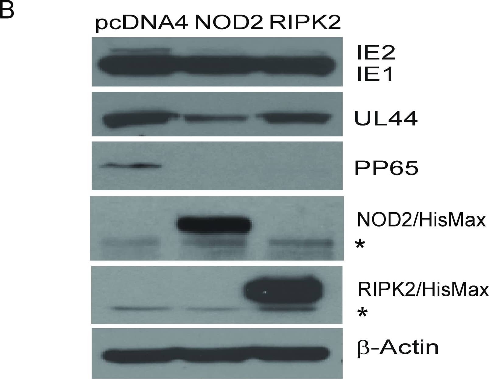 Western Blot: NOD2 Antibody (2D9) - BSA Free [NB100-524] - Overexpression of NOD2 restricts HCMV replication & induces antiviral & pro-inflammatory cytokines. B. Cell lysates from 4A used to determine protein expression of HCMV-immediate early (IE1/IE2), early (UL44), & late (pp65) genes. Levels of NOD2 & RIPK2 proteins measured to confirm NOD2 overexpression;  beta -actin served as loading control. WB data representative of 3 independent experiments. Asterisks (*) denote endogenous NOD2 & RIPK2 proteins. Image collected & cropped by CiteAb from the following publication (//dx.plos.org/10.1371/journal.pone.0092704), licensed under a CC-BY license. Not internally tested by Novus Biologicals.