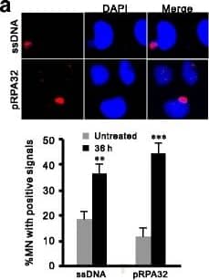 Active DNA end processing in late micronuclei compartments. a: Detection and quantification of RPA32 phosphorylation (pSerine 33) and ssDNA by specific antibodies in MN compartments of OVCAR-8 cells 36 h after 2-Gy irradiation. Note the nuclear signals have reduced while those in MN were intense. n = 3 biological repeats. Error bars = s.d. **P < 0.01; ***P < 0.005 (t-test). b: Immunostaining and enumeration of phosphorylated NBS1-pSerine 343, BRCA1-pSerine 1524 and TP53-pSerine 15 in MN compartments. **P < 0.01; ***P < 0.005 (t-test). c: Representative images (Upper panel) and quantification of RPA signal in MN compartments (Lower left) or RPA foci in nuclei (lower right) of post-IR OVCAR-8 cells after indicated treatments. Pro-resection genes (MRE11, BRCA1 and WDR70) were knockdown by specific siRNA. Percentage of positive RPA32-pS33 MN population was calculated after 36 h of IR treatment Image collected and cropped by CiteAb from the following open publication (//pubmed.ncbi.nlm.nih.gov/29661159), licensed under a CC-BY license. Not internally tested by Novus Biologicals.