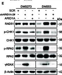 ARID1A participates in DDR in SCLC through the c-MYC/PARP axis. (A and B) Western blot analysis of DDR-related gene in DMS273 and DMS53 cells following ARID1A KD (A) or OE (B). (C and D) Representative images of immunofluorescence staining for  gamma -H2AX (C) and RAD51 (D) in DMS273 and DMS53 cells following ARID1A KD. Cells with more than 5 foci were considered positive. Quantification of  gamma -H2AX /RAD51 fluorescence intensities from 3 independent experiments was shown as mean +/- SD. Statistical analysis was performed using 2-tailed unpaired Student’s t tests. ****P < 0.0001. (E to G) Western blot analysis of the indicated proteins following ARID1A (E), c-MYC (F), or PARP1 (G) overexpression in ARID1A KD DMS273 and DMS53 cells. (H and I) Western blot analysis of PI3K downstream phospho-proteins in DMS273 and DMS53 cells following ARID1A KD (H) or OE (I). Image collected and cropped by CiteAb from the following open publication (//pubmed.ncbi.nlm.nih.gov/41049615), licensed under a CC-BY license. Not internally tested by Novus Biologicals.