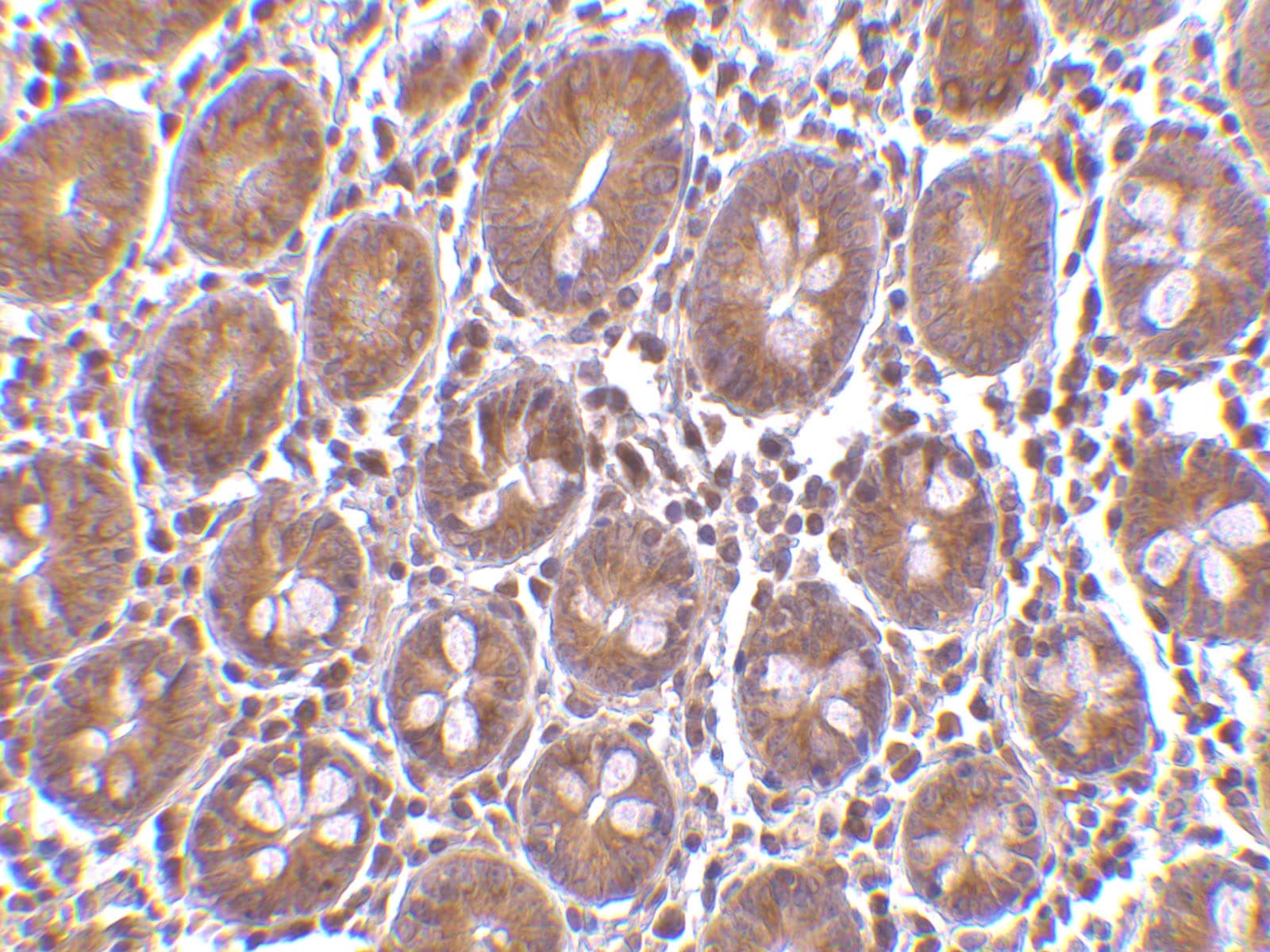 Immunohistochemistry: PTRH2 Antibody - BSA Free [NB100-55963] - Immunohistochemistry of PTRH2 in human small intestine tissue with PTRH2 antibody at 10 ug/mL.