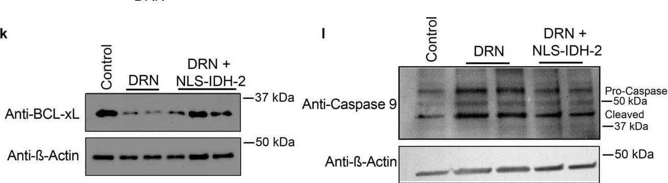 Nuclear translocation of TCA cycle enzymes prevents doxorubicin-mediated cellular damage.a–c Enzyme activity of IDH-2 (n = 4) (a), MDH-2 (n = 3) (b), and PDHC (n = 3) (c) in nuclei isolated from cells transduced with tetracycline-inducible NLS-IDH-2 constructs. Activity is represented as the rate in nM/min or  delta OD/min, p value* <0.05, p value**** = 0.0001, and lysates were probed for PCNA to detect equal nuclear protein amounts used for the assay. d Reduced apoptotic cell death as measured by Annexin:V:FITC staining in cells expressing nuclear TCA cycle dehydrogenases prior to doxorubicin DRN treatment. N = 3 p value* <0.05 (e) Quantification of troponin I released from cardiomyocytes as a marker of cardiac injury, minimum n = 4 p value** <0.007, p value* <0.05. f Cell death as measured by Cell Titer GloTM in cells expressing nuclear dehydrogenases prior to DRN treatment. minimum n = 4 p value*** = 0.0001, p value**** <0.0001. NLS-EGFP-2A-NLS-mCherry was used as a control for the 2 A linker system. g DNA damage as assessed by ɣ-H2AX foci formation. Scale bar 20 um. h, i qRT‒PCR showing the expression of anti-apoptotic genes BCL2 (h) and MCL1 (i). n = 3 P value ** <0.005, *<0.05. j–l Protein levels of anti-apoptotic proteins (j, k along with reduced caspase 9 cleavage (l) in cells expressing nuclear IDH-2 compared to cells treated with doxorubicin. Image collected and cropped by CiteAb from the following open publication (//pubmed.ncbi.nlm.nih.gov/37468519), licensed under a CC-BY license. Not internally tested by Novus Biologicals.
