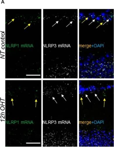 Immunocytochemistry/ Immunofluorescence: NLRP1/NALP1 Antibody [NB100-56148] - Gene expression & cellular distribution of NLRP1, NLRP3 & Aim2 sensors in the retina. (A) RNAscope analysis of NLRP1 (green dots, yellow arrows) & NLRP3 (white dots, white arrows) transcript abundance in normotensive control (NT control) & experimental (OHT) retinas at 12 h postinjury. (B) Aim2 transcript (red dots) abundance in normotensive control & experimental retinas. Co-staining for the Muller glia marker glutamine synthetase (GlSyn, green) is added to indicate cellular expression of Aim2 in the GCL layer (yellow arrows) & INL (white arrows) in control & 12 h post-OHT retinas. Bar, 25 μm on all panels. Image collected & cropped by CiteAb from the following publication (//pubmed.ncbi.nlm.nih.gov/30930743), licensed under a CC-BY license. Not internally tested by Novus Biologicals.