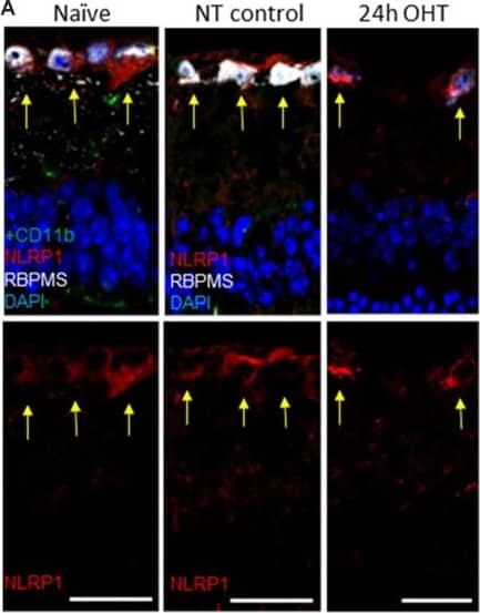 Immunocytochemistry/ Immunofluorescence: NLRP1/NALP1 Antibody [NB100-56148] - OHT-induced upregulation of Aim2 inflammasome in the retina. (A) NLRP1 antibody labeling (red) in the inner retina; yellow arrows indicate colocalization with RGC neurons (RBPSM+) in the GCL. (B) Immunohistochemistry for Aim2 protein (red) & Muller glia marker (GlSyn, green). Arrows show colocalization with Muller glia; no colocalization is detected with astrocytes (GFAP, white) in both control & 24 h post-OHT retinas. (C) NLRP3 labeling (green) in the inner retina of naïve & control eyes localized only to blood capillaries (white arrowhead) & astrocytes (yellow arrows), but not to RGCs (RBPMS cells). At 24 h post-injury the labeling in large cells in the GCL & INL (white arrows) are observed. (D) The NLRP1and NLRP3 proteins localized to distinct cell types in the GCL of naïve & NT control retinas: NLRP3 (green) is only expressed in blood vessels (white arrowheads). Twenty four hours after OHT, NLRP3 colocalizes with NLRP1 in RGCs (yellow arrows) & to RBPMS- cells (white arrows). Blue arrowheads denote labeling in RGC axons & dendrites. Bar, 25 μm on all panels. Image collected & cropped by CiteAb from the following publication (//pubmed.ncbi.nlm.nih.gov/30930743), licensed under a CC-BY license. Not internally tested by Novus Biologicals.