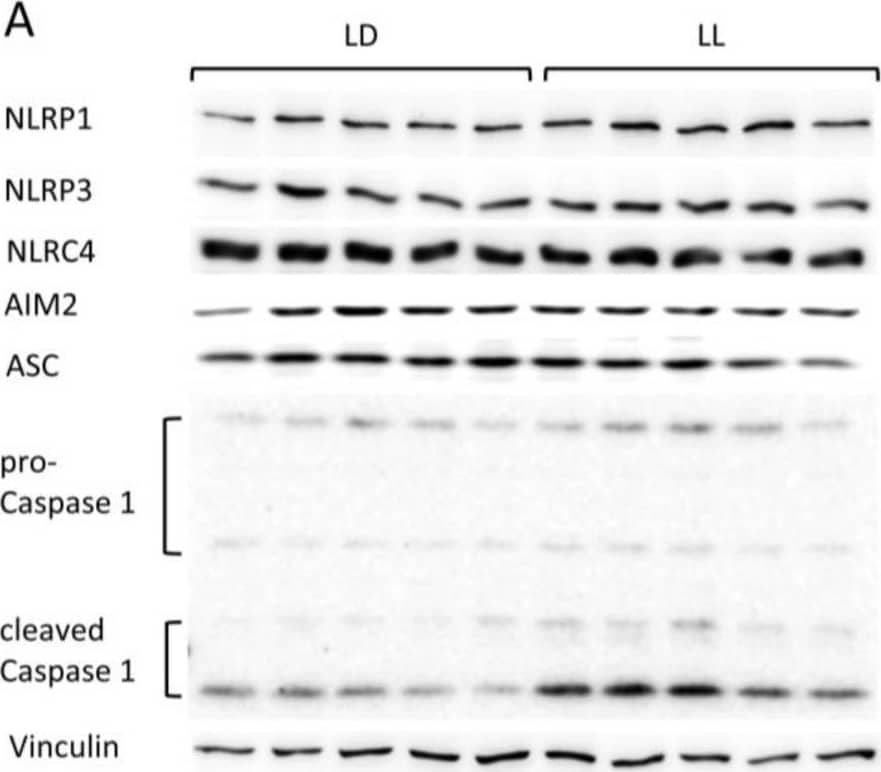 Western Blot NLRP1/NALP1 Antibody - BSA Free