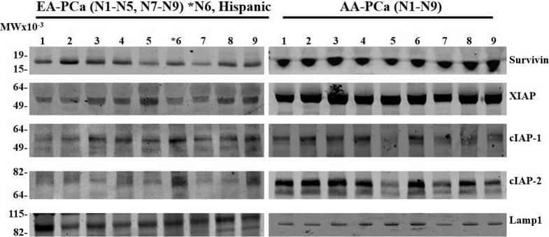 Representative Western blots showing the IAP levels in EV derived from individual European American (EA) (N1-N5) & (N7-N9), *N6 and African American (AA) (N1-N9) patients with prostate cancer (PCa).Specific antibodies against Survivin, XIAP, cIAP-1, cIAP-2, and Lamp1 were used for the Western blotting analysis of total exosomal proteins. The blots from both patient groups were processed under identical conditions; Lamp 1 was used as loading control. (*N6, Hispanic.) (Both blots were done side by side in the same gel running and transferring apparatus, blocking, washing buffers, and antibody incubations were done in the same time, in the same incubating trays under the identical exposure to keep the consistencies.) Image collected and cropped by CiteAb from the following open publication (//pubmed.ncbi.nlm.nih.gov/28981528), licensed under a CC-BY license. Not internally tested by Novus Biologicals.