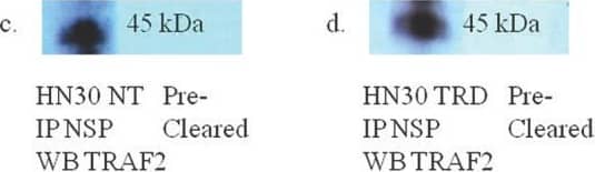 Western Blot: TRAF-2 Antibody [NB100-56173] - Western blot analysis of co-immunoprecipitations of asynchronous HN30 non-treated & HN30 cells transfected with pcDNA 3.0 NSP 5a3a & pcDNA 3.1/CT-GFP for 3 daysNT: non-treated HN30 cells, TRD: HN30 cells over-expressing NSP 5a3a. a. Immunoprecipitation of non-treated HN30 cells using rabbit anti-NSP 5a3a & western blot analysis using rabbit anti-DAXX., b. Immunoprecipitation of HN30 treated cells using rabbit anti-NSP 5a3a & western blot anaylsis using rabbit anti-DAXX., c. Immunoprecipitation of non-treated HN30 cells using rabbit anti-NSP 5a3a & western blot analysis using rabbit anti-TRAF2., d. Immunoprecipitation of HN30 treated cells using rabbit anti-NSP 5a3a & western blot analysis using rabbit anti-TRAF2., e. Immunoprecipitation of non-treated HN30 cells using rabbit anti-TRAF2/DAXX & western blot analysis using rabbit anti-NSP 5a3a, & f. Immunoprecipitation of HN30 treated cells using rabbit anti-TRAF2/DAXX & western blot analysis using rabbit anti-NSP 5a3a. Image collected & cropped by CiteAb from the following publication (//www.oncotarget.com/lookup/doi/10.18632/oncotarget.306), licensed under a CC-BY license. Not internally tested by Novus Biologicals.