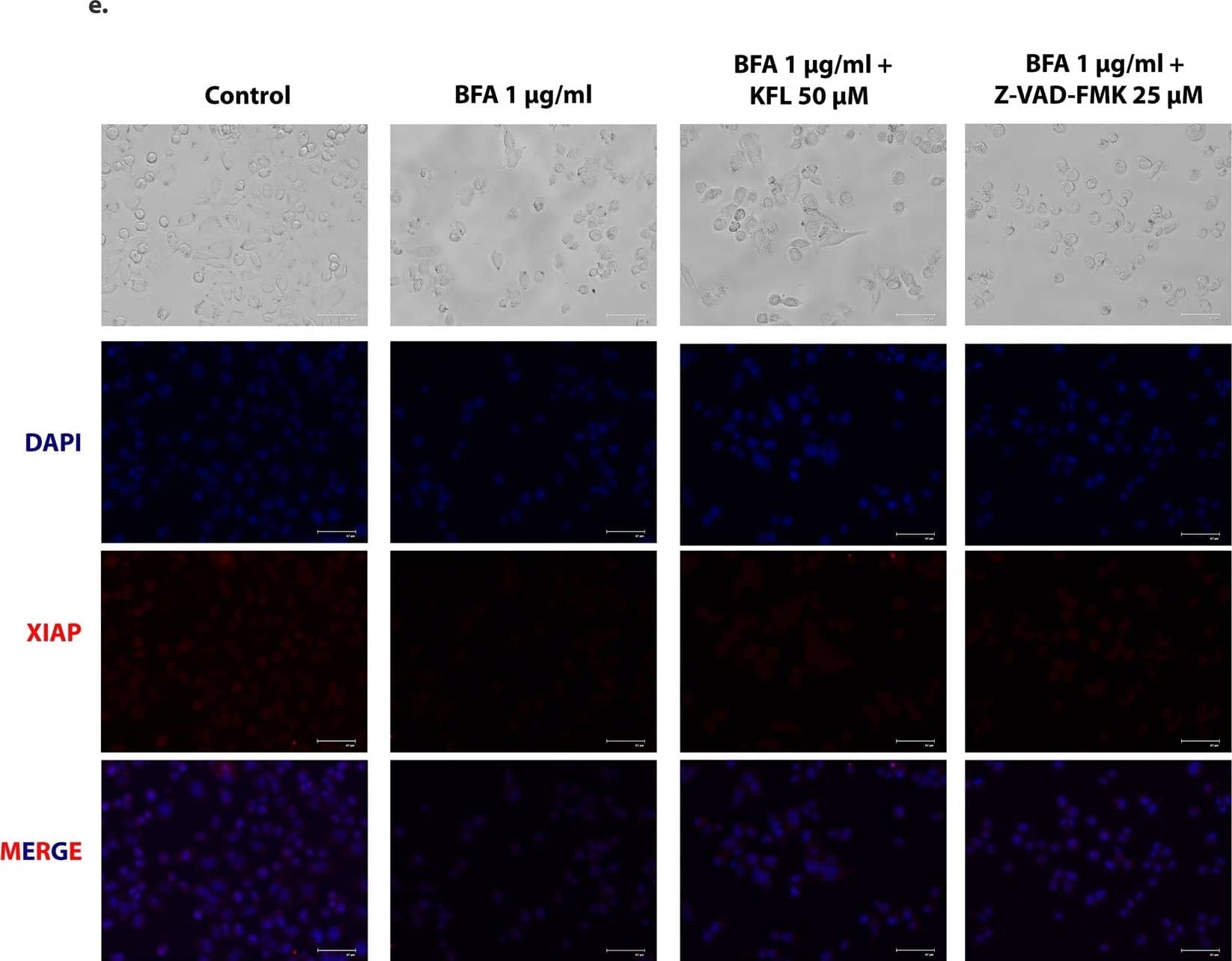 Immunocytochemistry/ Immunofluorescence: XIAP Antibody [NB100-56183] - Kaempferol inhibits the activity of caspase-3 enzyme. (a & b) Caspase-3 inhibition by kaempferol was measured using recombinant caspase-3 (enzyme) & Z-DEVD-aminoluciferin (substrate) with respect to time (a) & concentration (b). Ac-DEVD-CHO served as a positive control. (c) Dose response curve for kaempferol inhibition on caspase-3 enzyme activity. (d) Analysis of the inhibitory potential of estrogen receptor modulators on caspase-3 enzyme activity. Withanaloide A served as (−) control & Ac-DEVE-CHO as (+) control. Data represented as mean ± SEM of two independent experiments performed in duplicate. (e) Immunocytochemistry for XIAP expression levels in IMR32 cells after 24 hours of incubation in respective conditions (Scale bar: 67 µm). Image collected & cropped by CiteAb from the following publication (//www.nature.com/articles/s41598-018-20499-7), licensed under a CC-BY license. Not internally tested by Novus Biologicals.