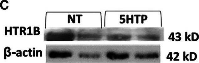 Expression of serotonin receptors in endothelial and eosinophils (mouse and brain control). (A) Mouse endothelial cell line, NJ1638 mouse eosinophils and C57BL/6 mouse brain tissue were analyzed for HTRs by qPCR. (B–D) Mouse endothelial cells with and without 5HTP (125 uM) were examined for HTR1A, HTR1B and HTR3A protein expression was analyzed by western blot. (E) Human microvascular endothelial cell and F) Human peripheral blood eosinophil protein expression of HTRs was analyzed by western blot. Panel (E,F) were not normalized to GAPDH because regulation of expression was not assessed. Image collected and cropped by CiteAb from the following open publication (//pubmed.ncbi.nlm.nih.gov/38845678), licensed under a CC-BY license. Not internally tested by Novus Biologicals.