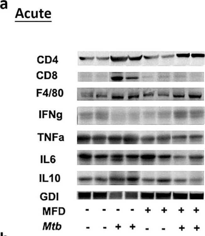 MFD alters immune signaling in adipose tissue during (a) acute and (b) chronic Mtb infection. Immunoblot analysis of immune cells (CD4, CD8, and F4/80) and inflammatory markers (IFN gamma , TNF alpha , IL-6, and IL-10) in the WAT lysates of RD-fed and MFD-fed uninfected and infected C57BL/6 mice during acute infection (30 DPI) and chronic (3 months) post-infection is shown. The error bars represent standard error of the mean. * p < 0.05, ** p < 0.01, and *** p < 0.001 between indicated groups. Image collected and cropped by CiteAb from the following open publication (//pubmed.ncbi.nlm.nih.gov/36676177), licensed under a CC-BY license. Not internally tested by Novus Biologicals.