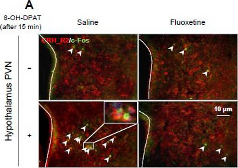 Immunocytochemistry/ Immunofluorescence CRHR2/CRF2 Antibody - BSA Free